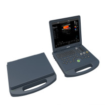 C60 15 inch LED screen laptop ultrasound machine color doppler ultrasonic scanner